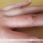 Завладела золотом с помощью ножа. В Витебске задержана 25-летняя девушка за совершение разбоя